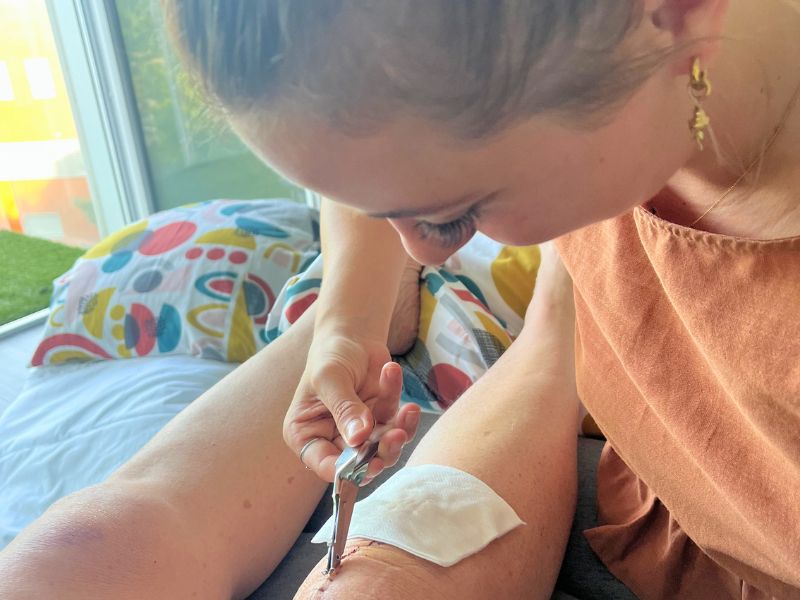 Nurse removing staples as part of caregiving post-knee replacement surgery